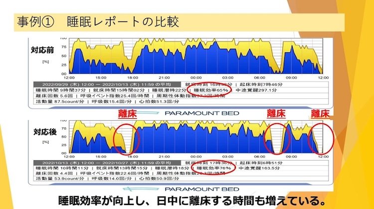 事例① 睡眠レポートの比較